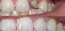 Periodoncia 2