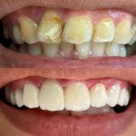 Estética dental y Rehabilitación Oral