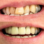Rehabilitación oral y estética dental